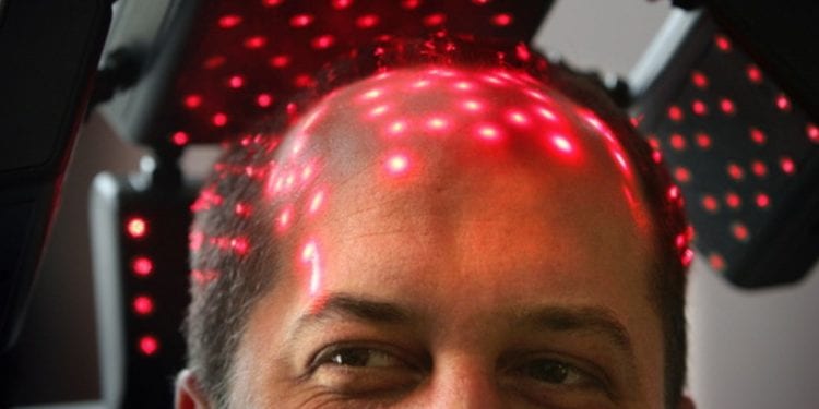 Low Level Light Therapy Technology for Hair Growth