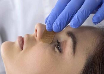 Complications of Untreated Deviated Nasal Septum