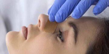 Complications of Untreated Deviated Nasal Septum