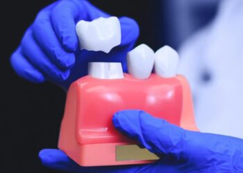 10 Pros And Cons Of Dental Crown Procedures