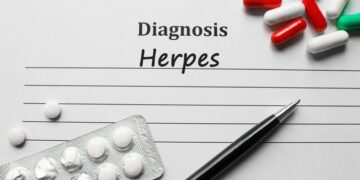 Shame Is So Last Century: How to Live Confidently With a Herpes Diagnosis